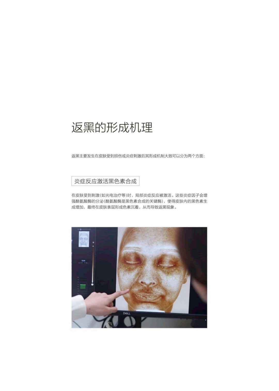 倩碧｜2025院线专研光电返黑人群白皮书